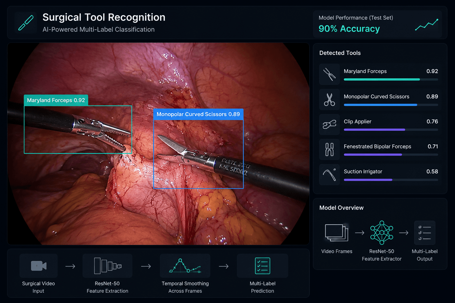 Surgical Tool Recognition System